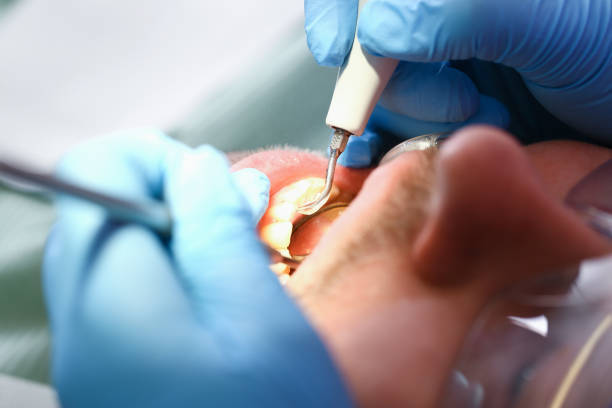 Best Pediatric Emergency Dentist in Port Neches, TX