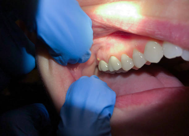 Best Cosmetic Emergency Dentistry in Port Neches, TX